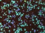Φωσφορίζοντα Turquoise Βότσαλα 2-3 cm - Image 4
